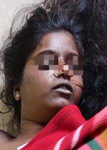 प्रयेसीचा खून करून प्रियकराची आत्महत्या