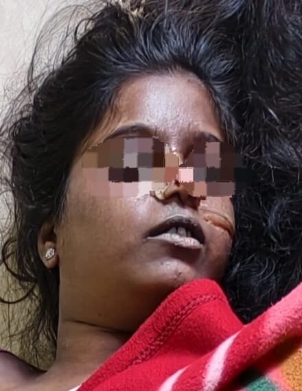 प्रयेसीचा खून करून प्रियकराची आत्महत्या