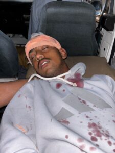 लोहगाव मध्ये कोयता गँग ने तरुणावर केले वार