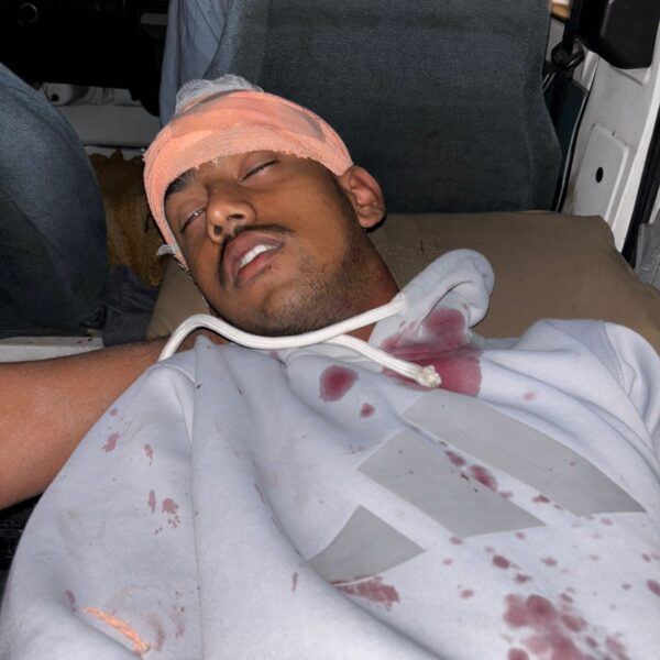 लोहगाव मध्ये कोयता गँग ने तरुणावर केले वार